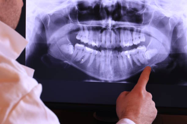 Best Emergency Gum Treatment in Campbell, OH